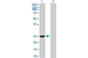 Western Blot analysis of HSPB8 expression in transfected 293T cell line by HSPB8 monoclonal antibody (M02), clone 5D7. (HSPB8 抗体  (AA 97-196))