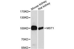 Western blot analysis of extracts of various cell lines, using MST1 antibody.