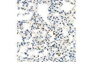 Immunohistochemistry of paraffin embedded mouse pneumonia using CCL3 (ABIN7073450) at dilution of 1:1000 (400x lens) (CCL3 抗体)