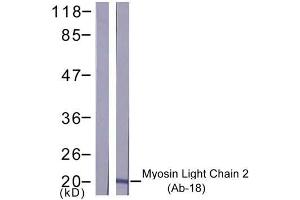 Western blot analysis of extract from K562 cells, using Myosin Light Chain 2 (Ab-18) antibody (E021157). (Myosin 抗体)