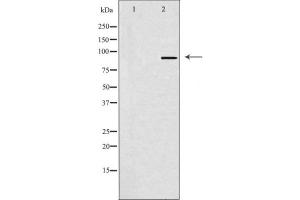Western blot analysis of SOX6 Antibody expression in Hela cells lysates. (SOX6 抗体  (N-Term))