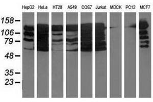 Image no. 1 for anti-Budding Uninhibited By Benzimidazoles 1 Homolog beta (Yeast) (BUB1B) antibody (ABIN1496997) (BUB1B 抗体)