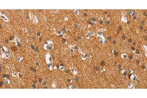 Immunohistochemistry of paraffin-embedded Human brain tissue using COX5A Polyclonal Antibody at dilution 1:40 (COX5A 抗体)
