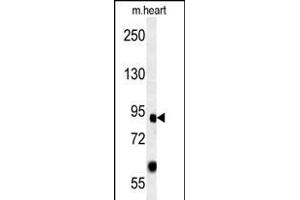 FOXP2 Antibody (C-term) (ABIN651939 and ABIN2840465) western blot analysis in mouse heart tissue lysates (15 μg/lane). (FOXP2 抗体  (AA 657-684))