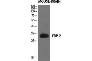 Western Blot (WB) analysis of specific cells using FRP-2 Polyclonal Antibody. (SFRP2 抗体  (Internal Region))