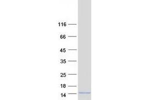 Validation with Western Blot