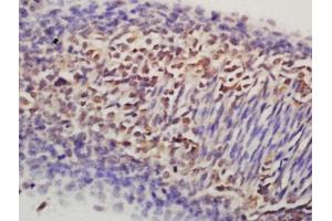 Immunohistochemistry (Paraffin-embedded Sections) (IHC (p)) image for anti-Nanog Homeobox (NANOG) (AA 101-200) antibody (ABIN2177828)
