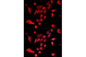 Immunofluorescence analysis of U2OS cells using MAD2L1 antibody (ABIN5970848). (MAD2L1 抗体)