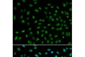 Immunofluorescence analysis of MCF-7 cells using DDB2 Polyclonal Antibody (DDB2 抗体)