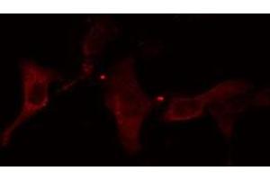 ABIN6278644 staining HuvEc cells by IF/ICC. (TMPRSS3 抗体  (Internal Region))