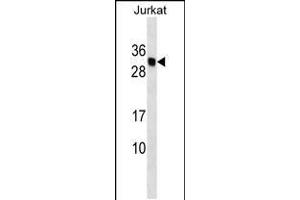 Western blot analysis in Jurkat cell line lysates (35ug/lane). (HLA-DMB 抗体  (AA 127-154))