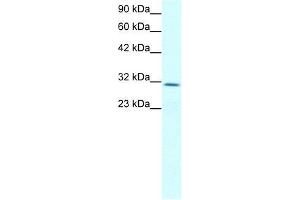 Human Jurkat; WB Suggested Anti-CLDN17 Antibody Titration: 2. (Claudin 17 抗体  (Middle Region))