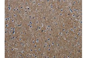 The image on the left is immunohistochemistry of paraffin-embedded Human brain tissue using ABIN7129632(GNG2 Antibody) at dilution 1/60, on the right is treated with fusion protein. (GNG2 抗体)