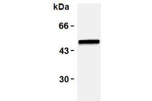 Western Blotting (WB) image for anti-Vimentin (VIM) antibody (ABIN1109484) (Vimentin 抗体)