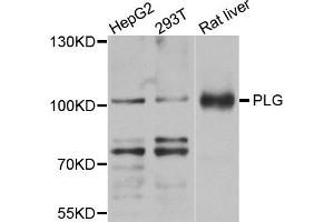 Western blot analysis of extracts of various cell lines, using PLG antibody (ABIN5971711) at 1/1000 dilution. (PLG 抗体)