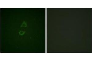 Immunofluorescence analysis of A549 cells, using Vinculin (Ab-821) Antibody. (Vinculin 抗体  (AA 786-835))