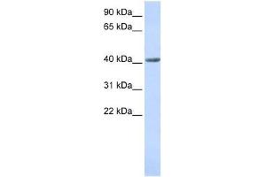 SMYD3 antibody used at 0. (SMYD3 抗体  (N-Term))