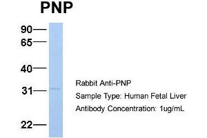 Host:  Rabbit  Target Name:  PNP  Sample Type:  Human Fetal Liver  Antibody Dilution:  1. (NP (Middle Region) 抗体)