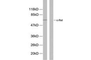Western blot analysis of extracts from MDA-MB-435 cells, using Rel (Phospho-Ser503) Antibody. (c-Rel 抗体  (pSer503))