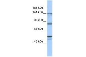 Image no. 1 for anti-CSE1 Chromosome Segregation 1-Like (CSE1L) (N-Term) antibody (ABIN6744330) (Exportin 2 抗体  (N-Term))