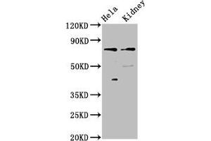 Western Blot Positive WB detected in: Hela whole cell lysate, Rat kidney tissue All lanes: CLCNKB antibody at 3 μg/mL Secondary Goat polyclonal to rabbit IgG at 1/50000 dilution Predicted band size: 76, 57 kDa Observed band size: 76 kDa