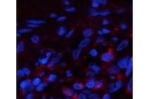 Immunofluorescence analysis of Human lung tissue using PPIB Monoclonal Antibody at dilution of 1:200. (PPIB 抗体)