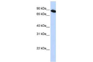 ZNF780A antibody used at 0. (ZNF780A 抗体  (N-Term))