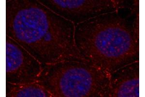 Immunofluorescence analysis of methanol-fixed MCF-7 cells using Phospho-IGF1R(Y1161) Polyclonal Antibody (IGF1R 抗体  (pTyr1161))