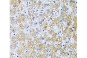 Immunohistochemistry of paraffin-embedded Human liver using ASB4 Polyclonal Antibody at dilution of 1:100 (40x lens). (ASB4 抗体)