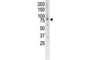 Western blot analysis of MUSK antibody and placenta cell lysate (MUSK 抗体  (AA 829-859))