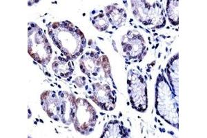 G3BP1 antibody immunohistochemistry analysis in formalin fixed and paraffin embedded human stomach tissue. (G3BP1 抗体  (AA 401-430))