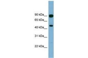Image no. 1 for anti-Acylglycerol Kinase (AGK) (AA 107-156) antibody (ABIN6744135) (Acylglycerol Kinase 抗体  (AA 107-156))