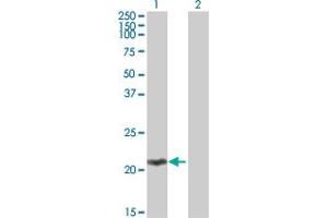 Western Blot analysis of MOBKL2C expression in transfected 293T cell line by MOBKL2C MaxPab polyclonal antibody. (MOBKL2C 抗体  (AA 1-216))