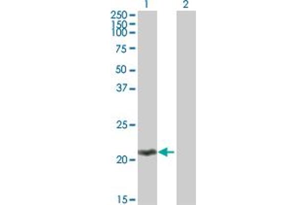 MOBKL2C 抗体  (AA 1-216)