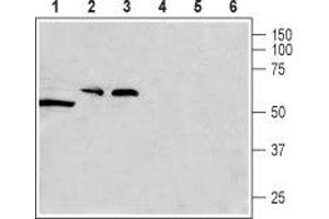 Western blot analysis of rat testis (lanes 1 and 4), rat brain (lanes 2 and 5) and mouse brain (lanes 3 and 6) lysates: - 1-3. (CACNG8 抗体  (Intracellular, N-Term))