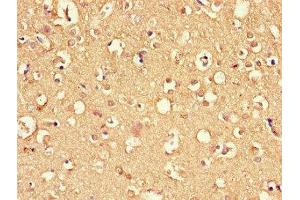 Immunohistochemistry of paraffin-embedded human brain tissue using ABIN7166807 at dilution of 1:100
