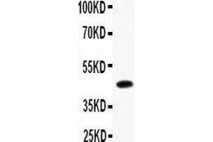 Western Blotting (WB) image for anti-B-cell antigen receptor complex-associated protein alpha chain (CD79A) (AA 121-226) antibody (ABIN3043397) (CD79a 抗体  (AA 121-226))
