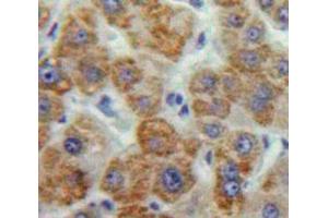 Used in DAB staining on fromalin fixed paraffin-embedded Liver tissue (MMP16 抗体  (AA 351-557))