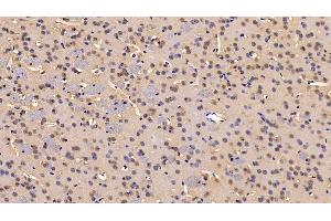 Immunohistochemistry (IHC) image for anti-Insulin-Degrading Enzyme (IDE) (AA 753-973) antibody (ABIN7434305)