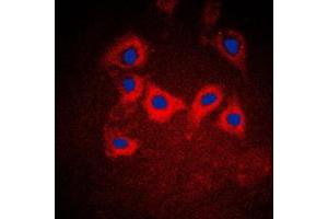 Immunofluorescent analysis of Cytokeratin 10 staining in A431 cells. (Keratin 10 抗体  (Center))