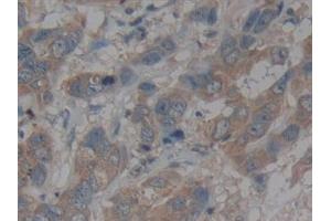 Immunohistochemistry (IHC) image for anti-Chemokine (C-X3-C Motif) Ligand 1 (CX3CL1) (AA 25-332) antibody (ABIN7438127)