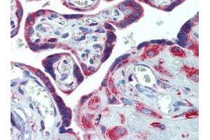 Placenta, Human: Formalin-Fixed, Paraffin-Embedded (FFPE) (PDIA4 抗体  (AA 623-638))