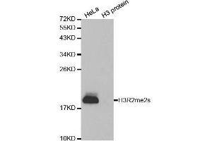 Western blot analysis of extracts of various cell lines, using Symmetric DiMethyl-Histone H3-R2 antibody. (Histone 3 抗体  (H3R2me2))