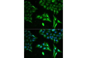 Immunofluorescence analysis of U20S cell using ACADS antibody. (ACADS 抗体)