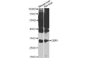 Western blot analysis of extracts of various cell lines, using CER1 Antibody (ABIN4903254) at 1:1000 dilution. (CER1 抗体)
