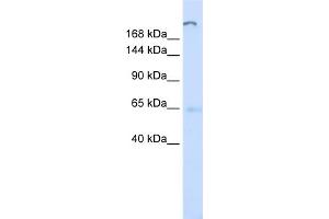 WB Suggested Anti-ATP10D Antibody Titration:  0. (ATP10D 抗体  (C-Term))