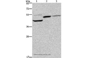 Western blot analysis of Mouse heart, kidney and liver tissue, using CYR61 Polyclonal Antibody at dilution of 1:350 (CYR61 抗体)