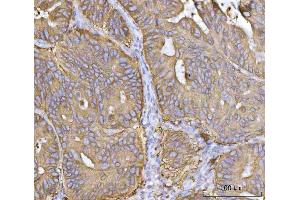IHC analysis of MRPS22 using anti-MRPS22 antibody (ABIN7600613). (MRPS22 抗体  (AA 21-329))