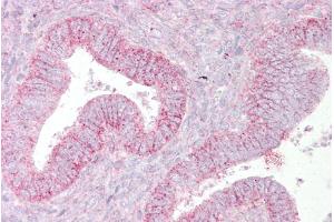 Immunohistochemistry with Uterus tissue at an antibody concentration of 5µg/ml using anti-SUFU antibody (ARP39233_P050) (SUFUH 抗体  (Middle Region))