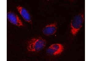 IF analysis of SRPRA using anti-SRPRA antibody (ABIN7601408). (SRPRA (AA 346-638) 抗体)